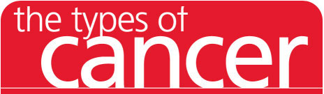 Types of Cancer Screening