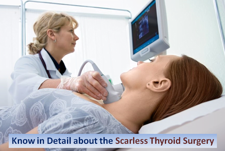 Know in Detail about the Scarless Thyroid Surgery