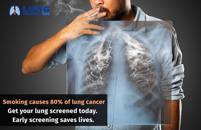 Lung cancer awareness Alzahra cancer center Dubai Sadir Alrawi. Dr Arun Kanala Dubai UAE May 2018
