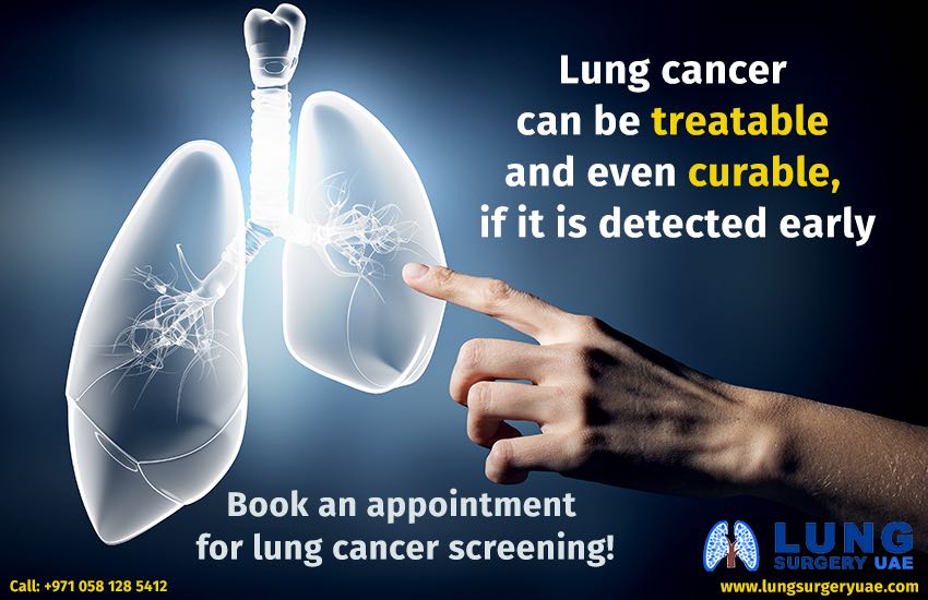 Lung cancer screening Alzahra cancer center Dubai UAE April 2018