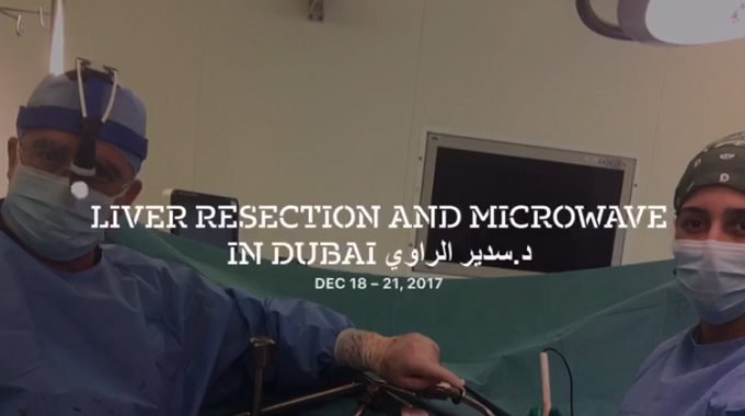 Liver resection and Microwave In Dubaiد.سدير الراوي.T