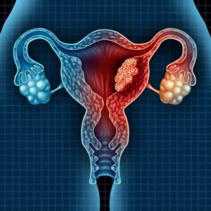 Pap smear and HPV test