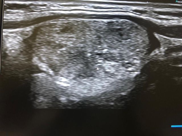 Colorectal Oncology UAE