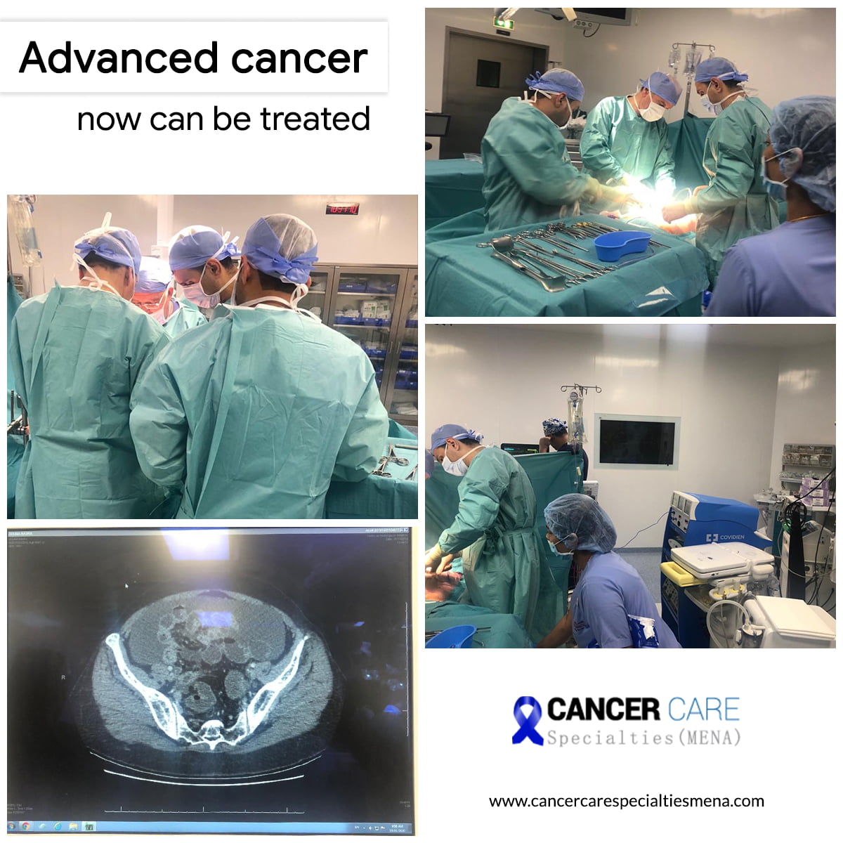 advanced cancer treatment