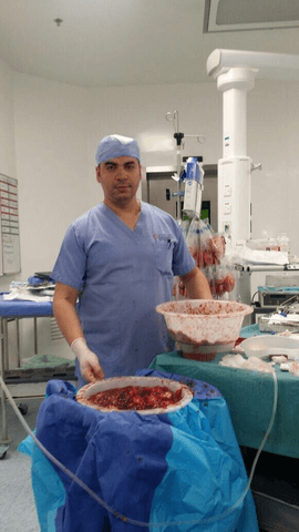 When HIPEC is the only option in salvage care and survival in peritonealcarcinomatosis by AlzahraDubai team in MENA in CovidEra