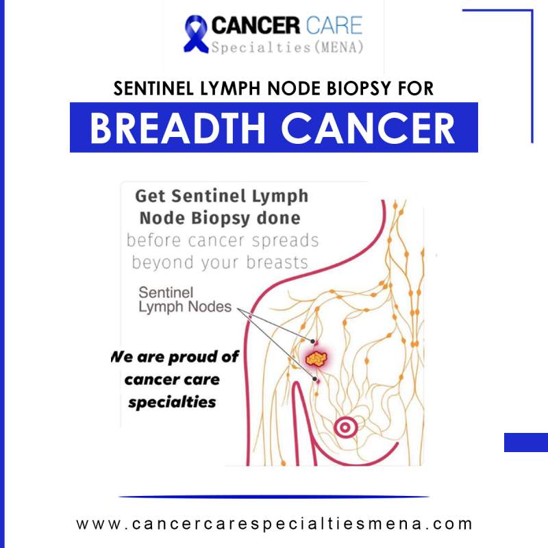 Sentinel lymph node biopsy for breadth cancer