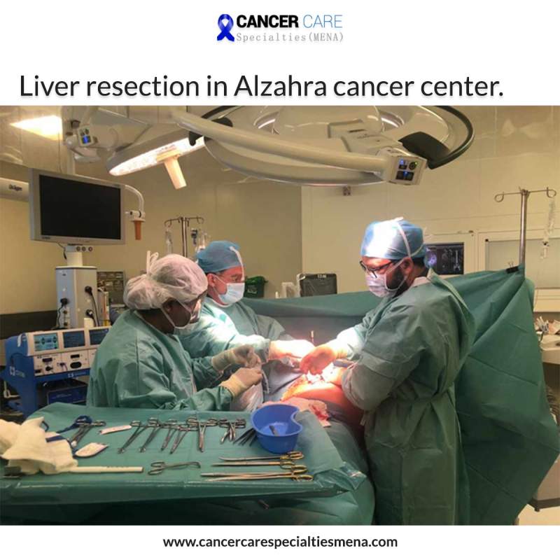 Liver resection in Alzahra cancer center