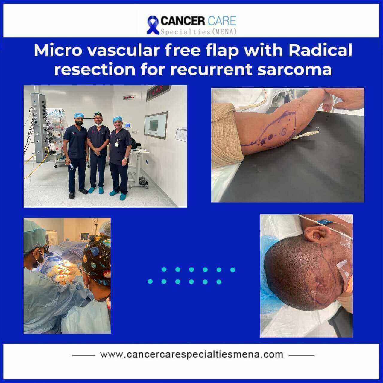 Micro vascular free flap with Radical resection for recurrent sarcoma