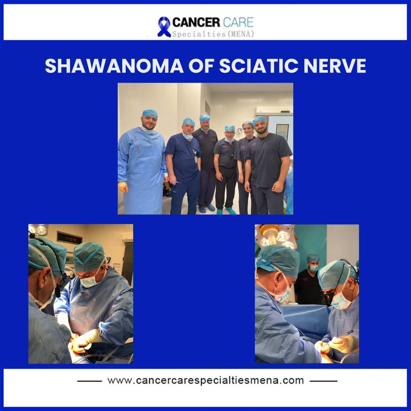 Shawanoma of sciatic nerve