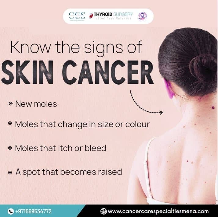 Know the signs of skin cancer