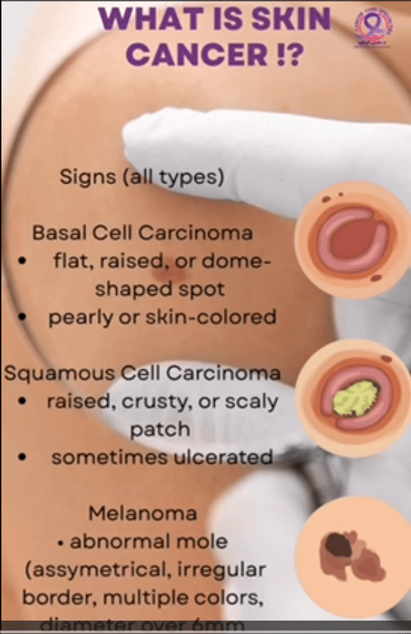 Melanoma Cancer Awareness